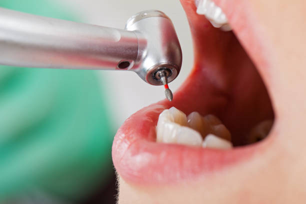 Best Emergency Dental Care for Sports Injuries in Kronenwetter, WI